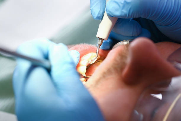 Best Emergency Dental Filling Replacement  in Westphalia, MD